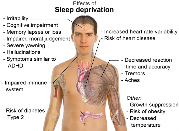 Sleep Deprivation