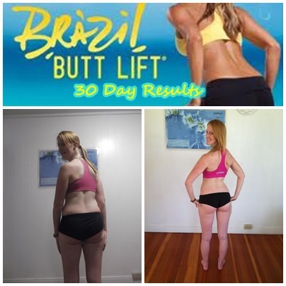 Brazil_Butt_lift